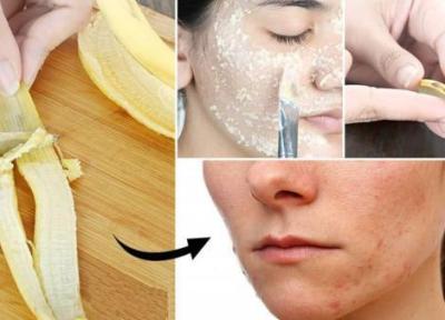 انوع ماسک پوست موز برای جوانسازی صورت